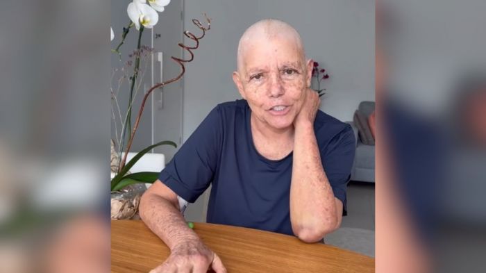 O tratamento é longo, maltrata, mas temos que enfrentar", revelou Roseana, cuja irmã foi casada com Beto (Fotos e vídeo: Instagram e Divulgação)