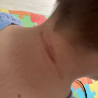 Mãe denuncia maus tratos sofridos pelos filhos em abrigo infantil