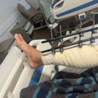 Motorista atacado por venezuelanos fica gravemente ferido em Itajaí