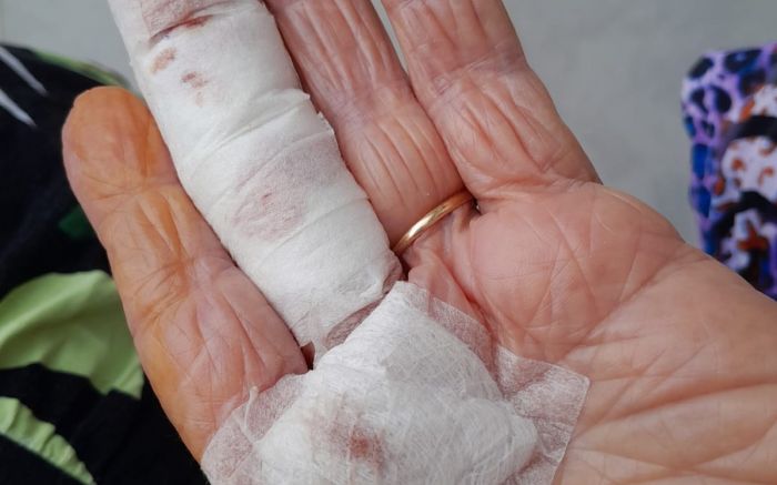 Casal de 90 e 93 anos sofreu cortes, hematomas e outras lesões após queda em unidade de saúde